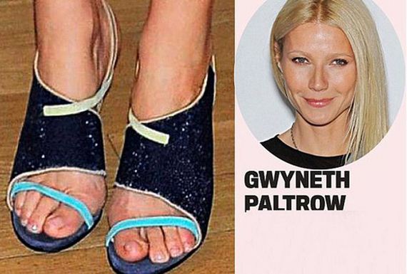 Celebrities with Ugly Feet - Barnorama