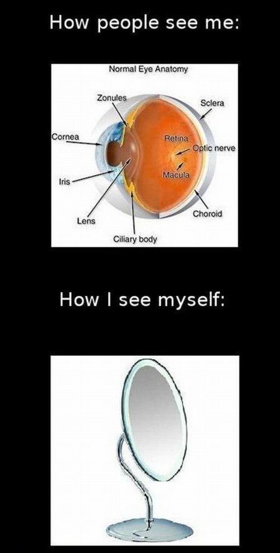 B1144