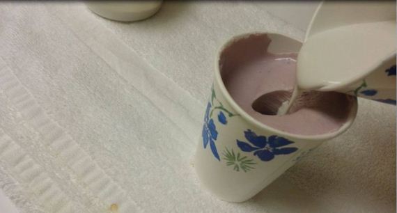 3_d_printed_prosthetic_foot
