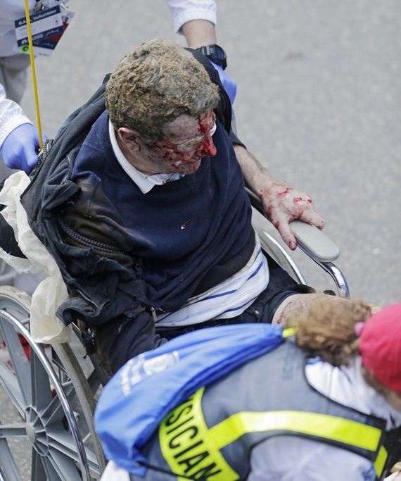 first-photos-from-scene-boston-marathon-explosion