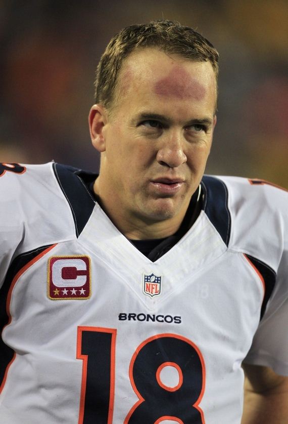manning's-forehead