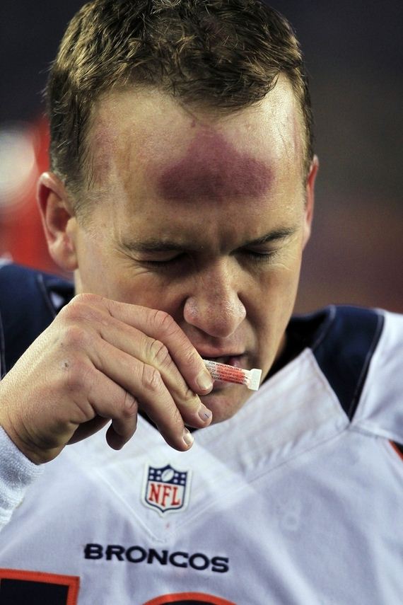 manning's-forehead