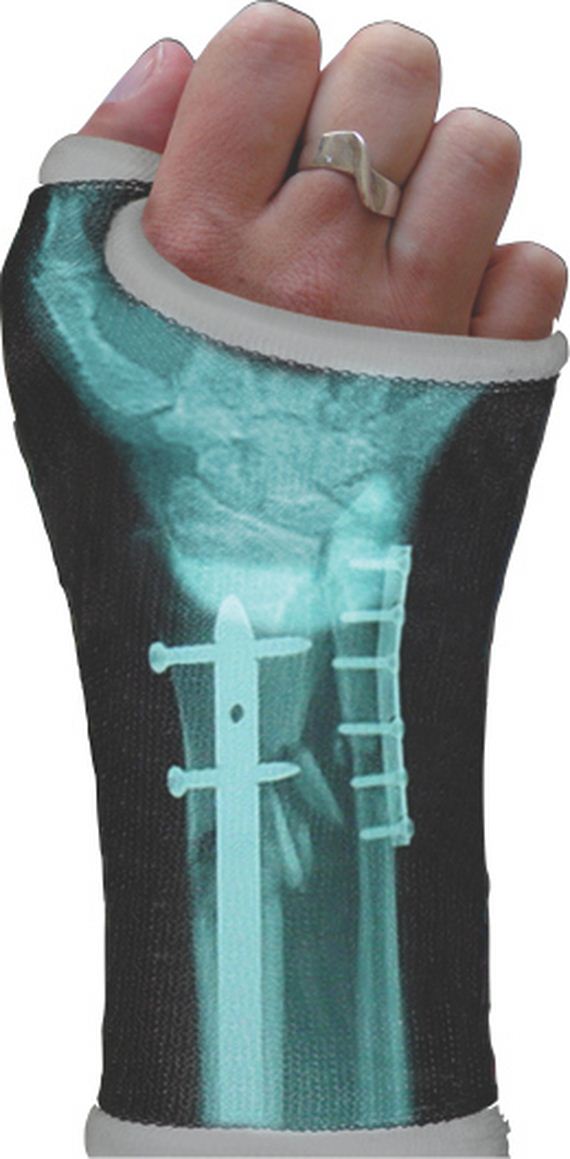 orthopedic-designs