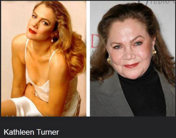 celebs-who-are-not-aging-very-well