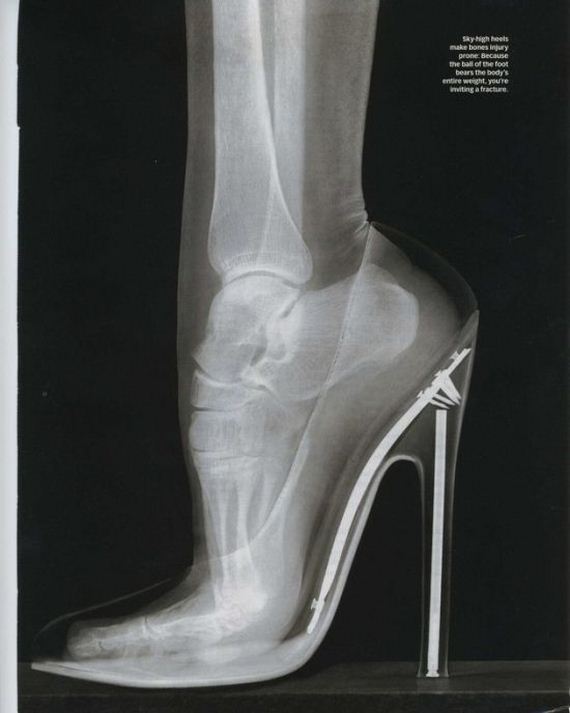 funny-pictures-618