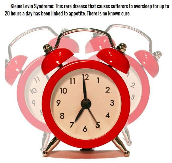 sleep_disorders