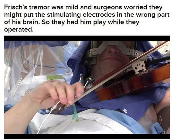 violin_during_his_own_brain_surgery