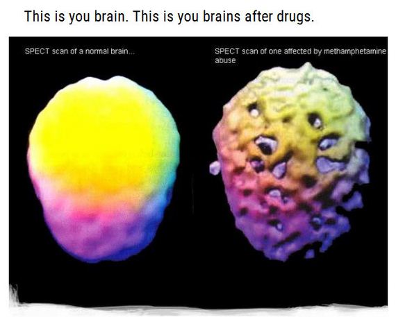 drugs_01