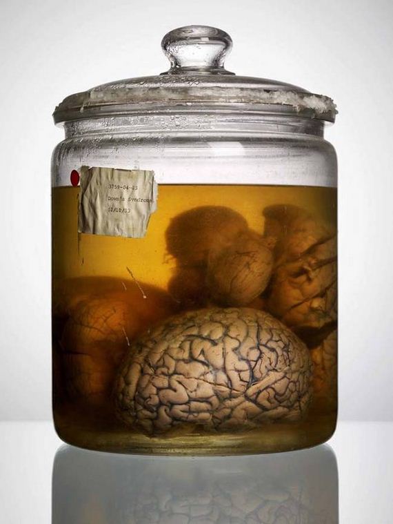 human-brains-morbidly-beautiful