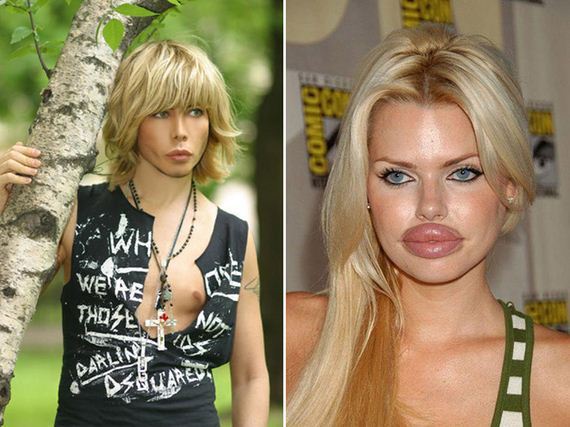 plastic_surgery