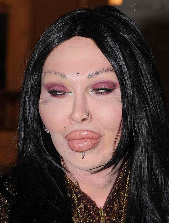 plastic_surgery