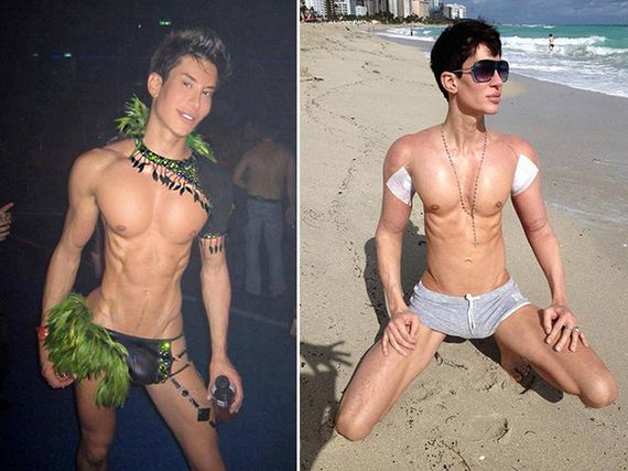 plastic_surgery