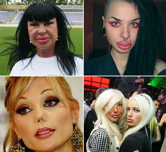plastic_surgery