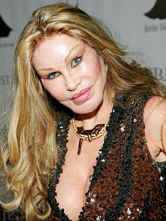 plastic_surgery