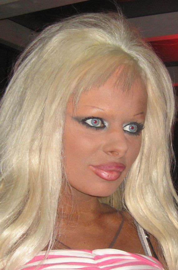 plastic_surgery