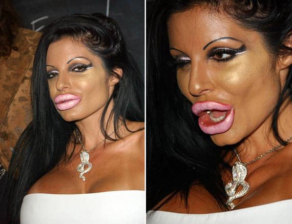 plastic_surgery