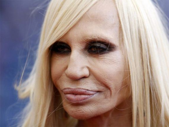 plastic_surgery