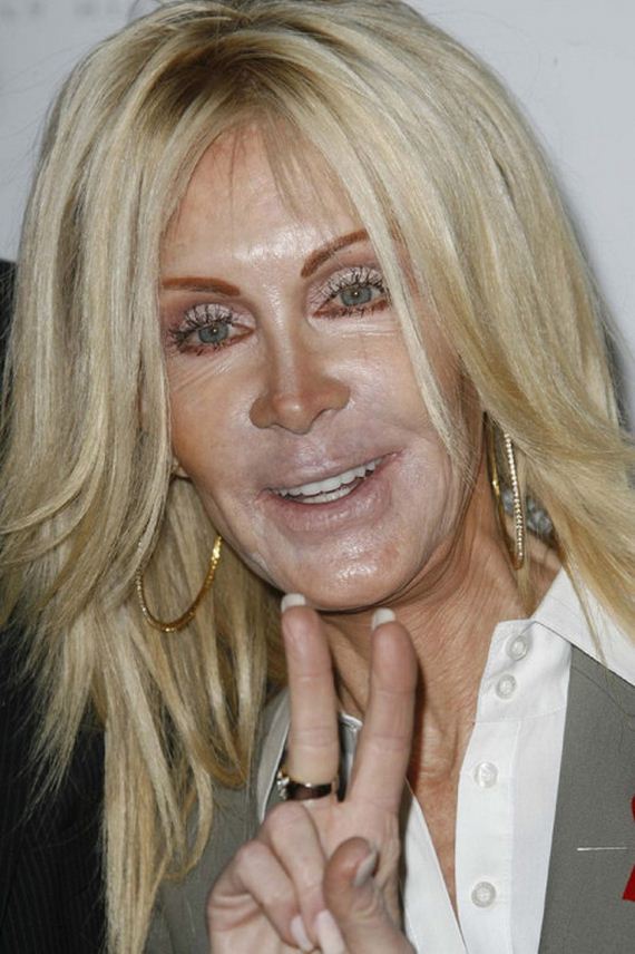 plastic_surgery
