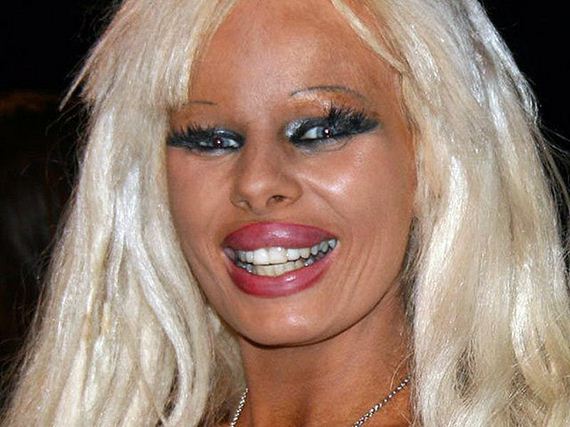 plastic_surgery