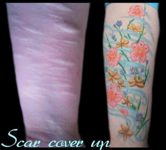 scars_cover_up