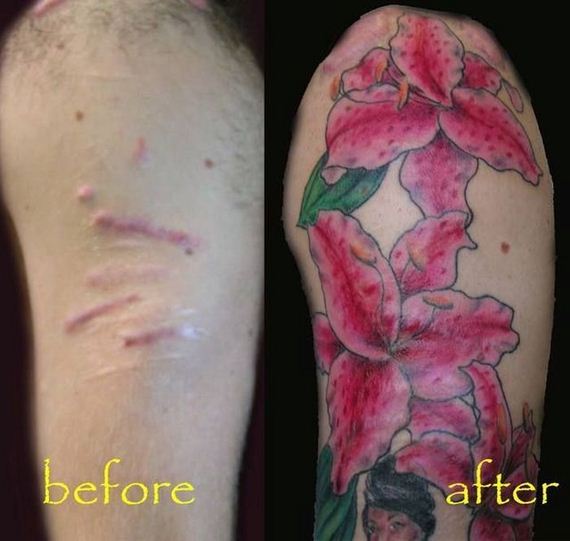 scars_cover_up