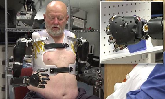 This Man Lived Without Arms For 40 Years, And Now He Has New Ones ...