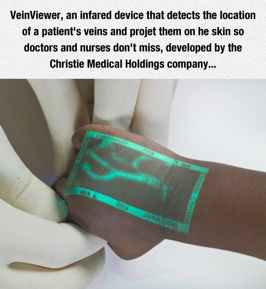 cool-veinviewer-scan-x-ray