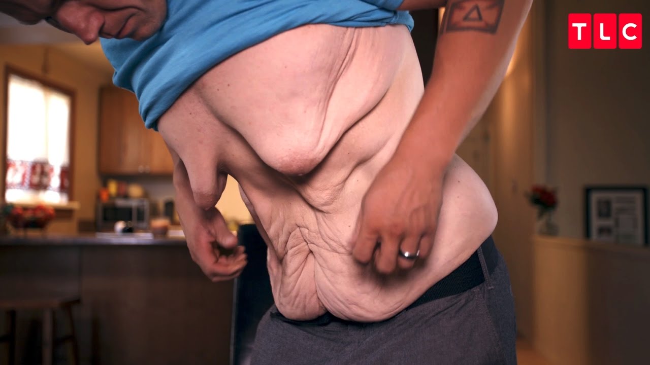 See This Man’s Physique After Losing Over 300 Pounds. 