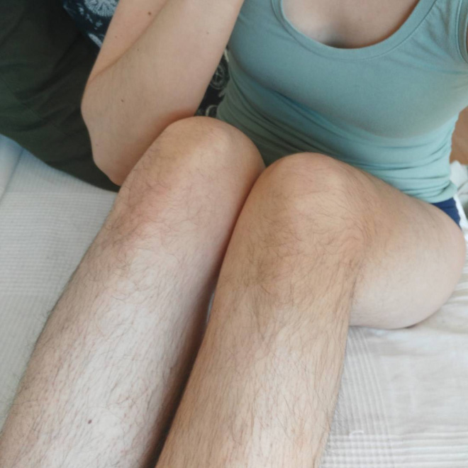 Awkward Instagram Beauty Trend: Women With Hairy Legs.