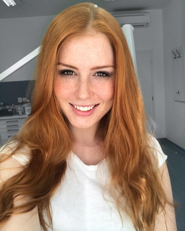 Study: Redheads Feel Pain Differently - The Frisky