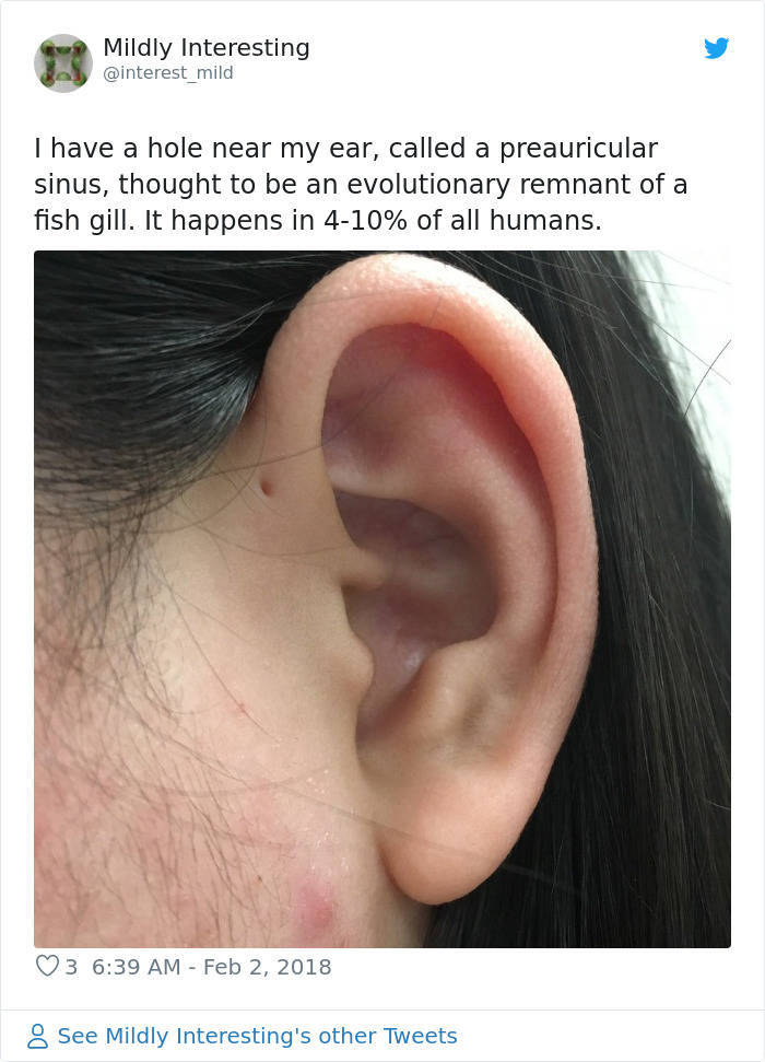 Why Some People Have A Tiny Hole Above Their Ears Barnorama