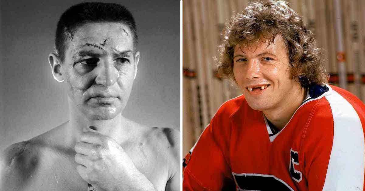 22 Hockey Players Sporting Epic Facial Injuries – Barnorama